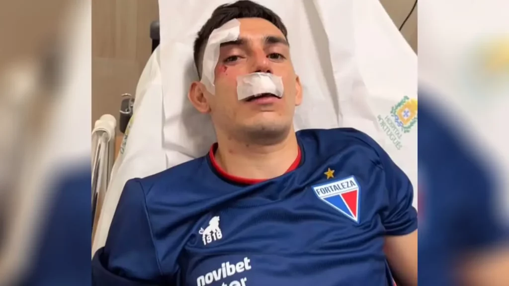 Fortaleza revela detalhes sobre jogadores hospitalizados após atentado