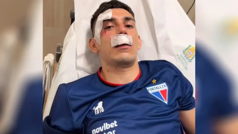 Fortaleza revela detalhes sobre jogadores hospitalizados após atentado